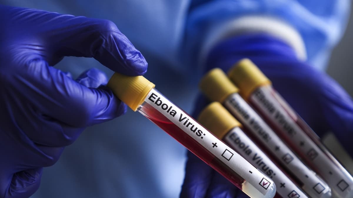 ÜST Konqoda Ebola ilə bağlı 900-dən çox ehtimal olunan yoluxma halı qeydə alındığını açıqlayıb