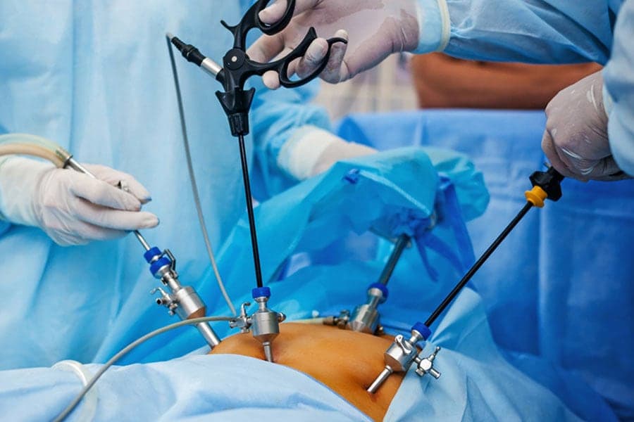 Laparoskopik cərrahiyyə pasiyentə sürətli bərpa imkanı yaradıb - Zəfəran Hospital