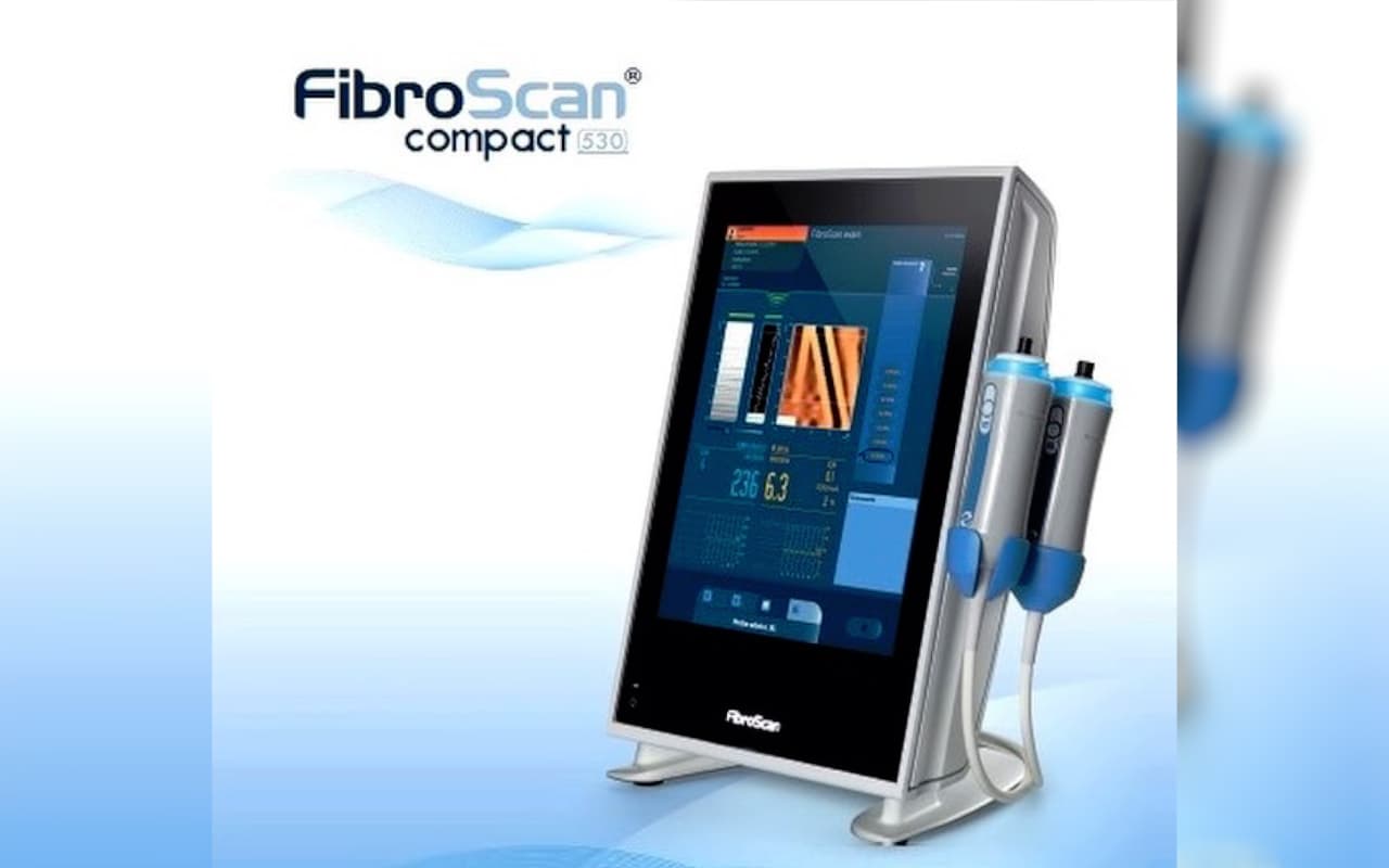 Qaraciyər fibroz və steatozunun diaqnostikasında yeni cihaz – FibroScan Compact 530