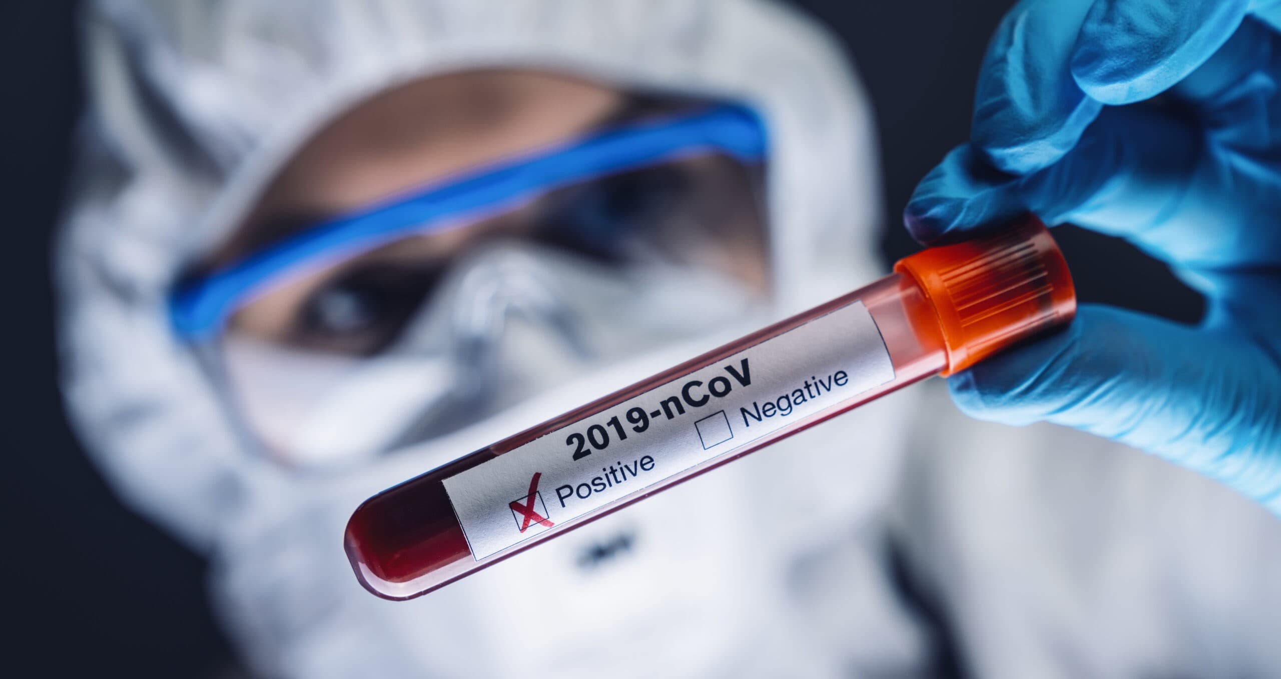 Azərbaycanda daha 61 nəfərdə koronavirus aşkarlanıb – RƏSMİ