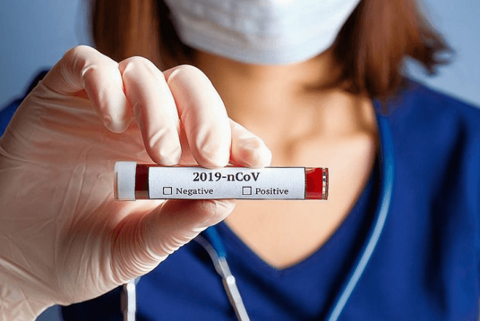 Azərbaycanda daha 41 nəfərdə koronavirus - TAPILDI