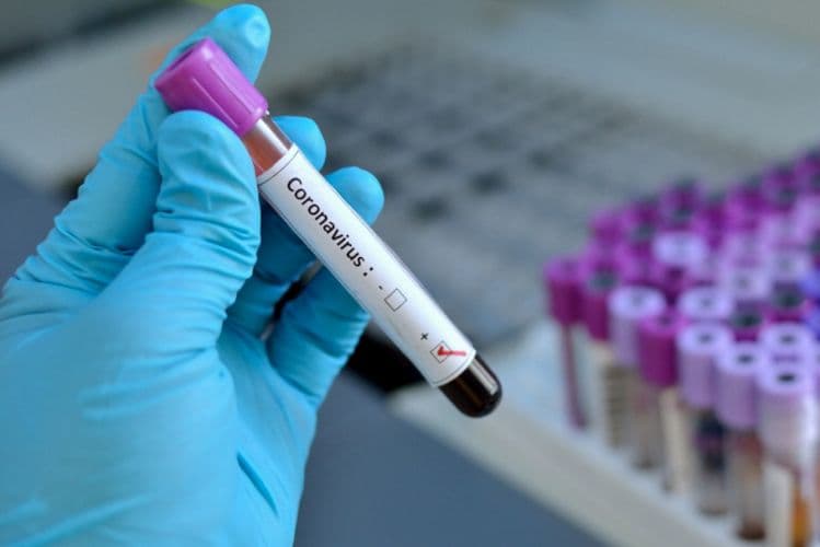 Əli Əsədov: "Koronavirus sınağından üzüağ çıxacağıq"