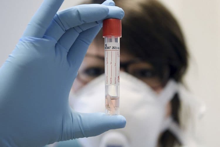 Azərbaycanda indiyədək koronavirus testi aparılıb
