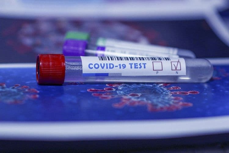 Azərbaycanda indiyədək neçəkoronavirus testi aparılıb?