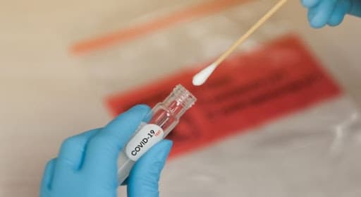 Azərbaycanda indiyədək aparılmış koronavirus testlərinin SAYI AÇIQLANDI
