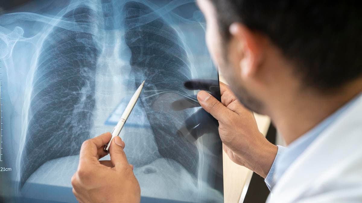 Alimlərdən 10 illik koronavirus proqnozu