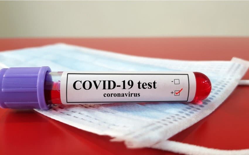 Son sutkada 601 nəfər COVID-19-dan sağalıb – RƏSMİ STATİSTİKA