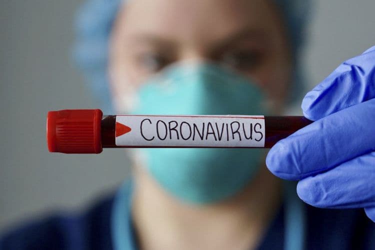 Azərbaycanda ümumilikdə 229584 nəfər COVID-19-a yoluxub, 3105 nəfər vəfat edib