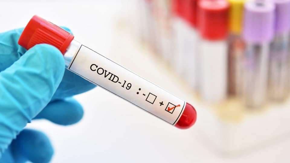 Azərbaycanda indiyədək 2 380 074 koronavirus testi aparılıb