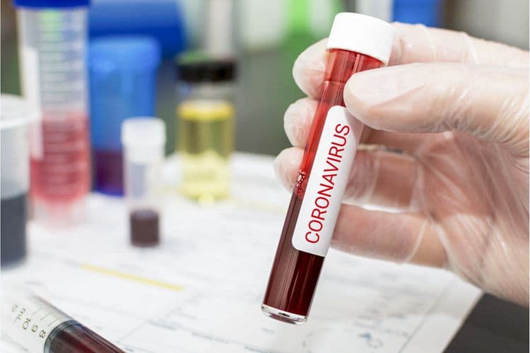 Bakıda 5 müəllim və məktəbəhazırlıq qrupundakı 1 uşaqda koronavirus aşkarlanıb
