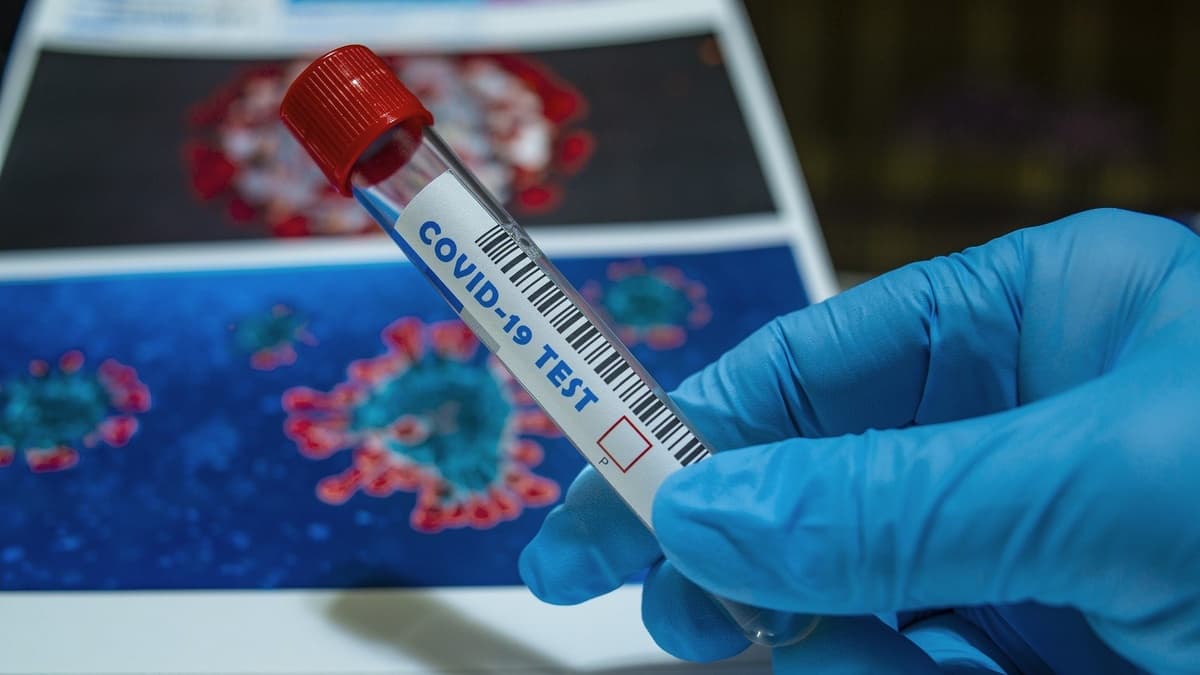Son sutkada koronavirus yoluxanların SAYI AÇIQLANDI