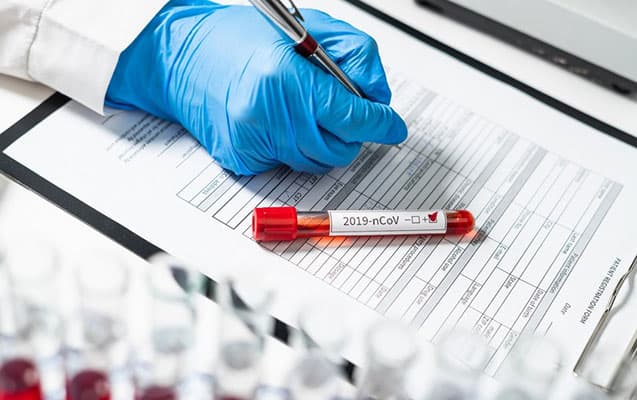 Son sutkada koronavirusa yoluxanların sayı açıqlandı – STATİSTİKA