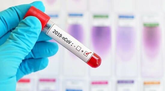 Koronavirusla bağlı SON STATİSTİKA