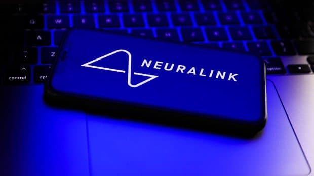 Maskın çılğın layihəsi Neuralink-də insan təcrübələri gəlir