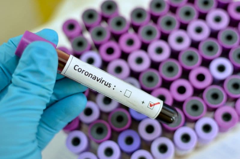 Koronavirusla bağlı SON STATİSTİKA