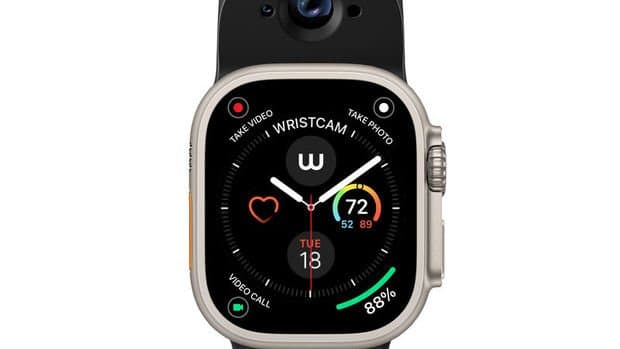 ABŞ-da Apple smart saatlarının satışı qadağan edilib
