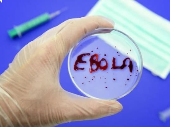 Çində mutant Ebola virusu yaradıldı
