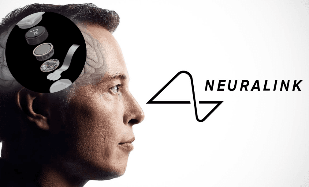 Neuralink uğurla ikinci xəstəyə çip implantasiya etdi
