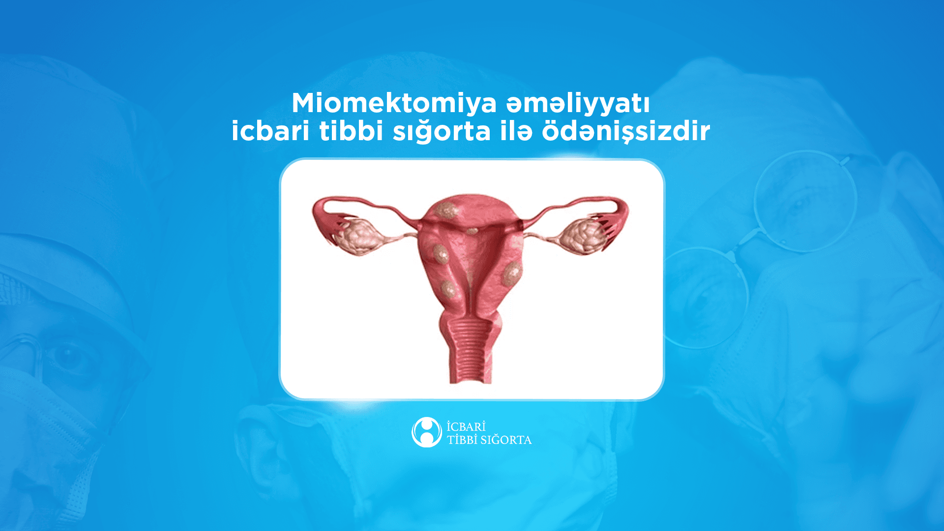Miomektomiya əməliyyatı icbari tibbi sığorta təminatına daxildir