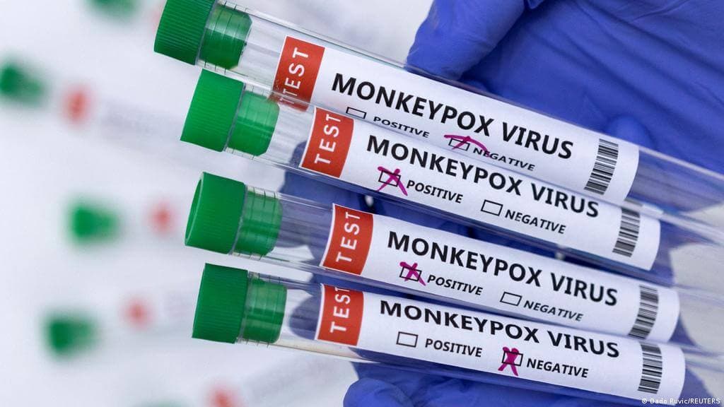Meymunçiçəyi epidemiyasının yeni hüdudları