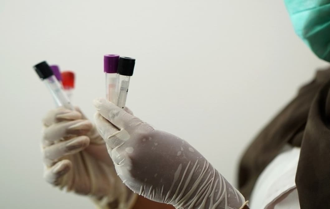 Avstraliya laboratoriyasında ölümcül virusu olan sınaq boruları yoxa çıxıb