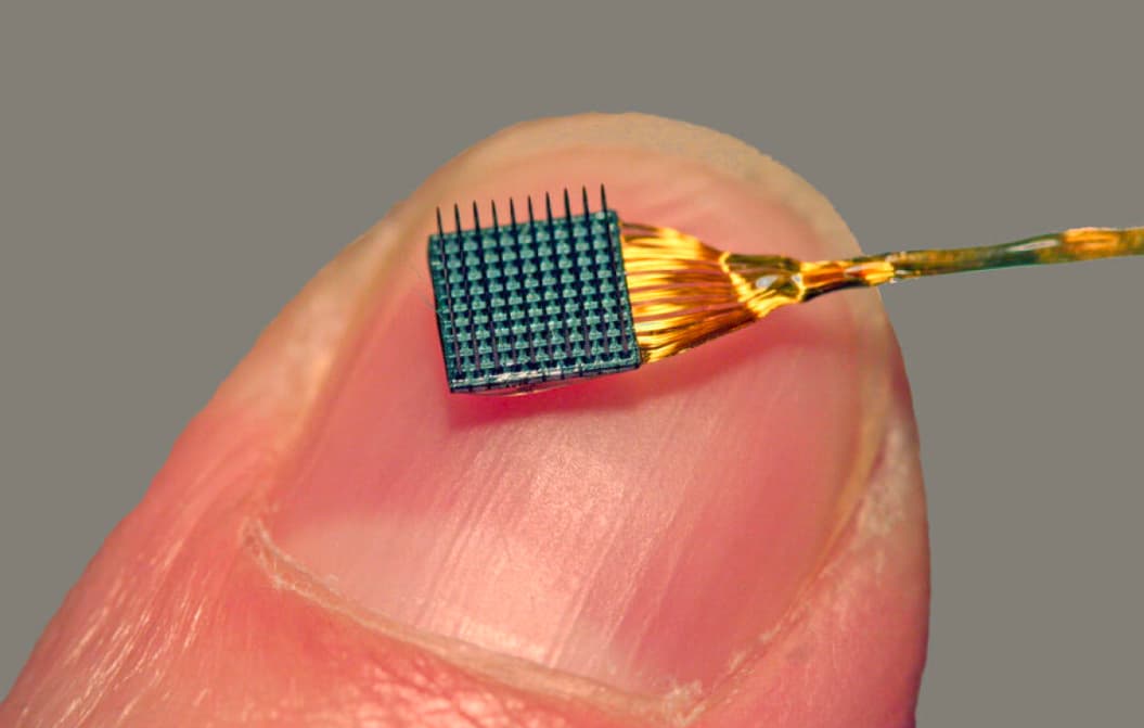 Musk Neuralink implantının ikinci bir insanın beyninə implantasiya edildiyini açıqladı
