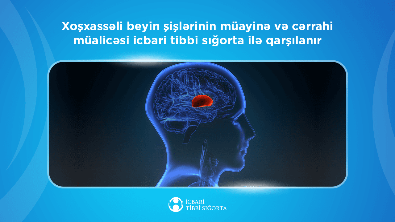 Xoşxassəli beyin şişlərinin müayinə və cərrahi müalicəsi
icbari tibbi sığortaya daxildir