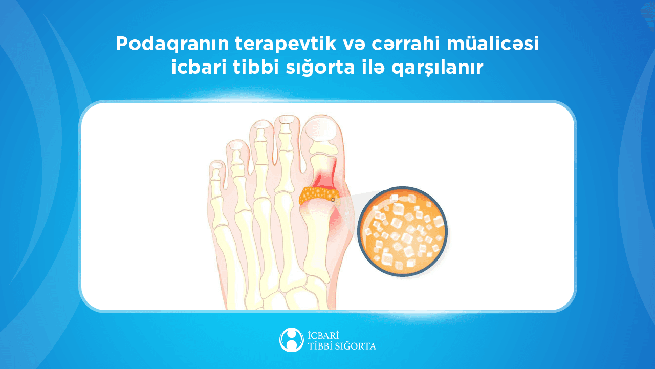 Podaqranın da müayinə və müalicəsi icbari tibbi sığortaya daxildir