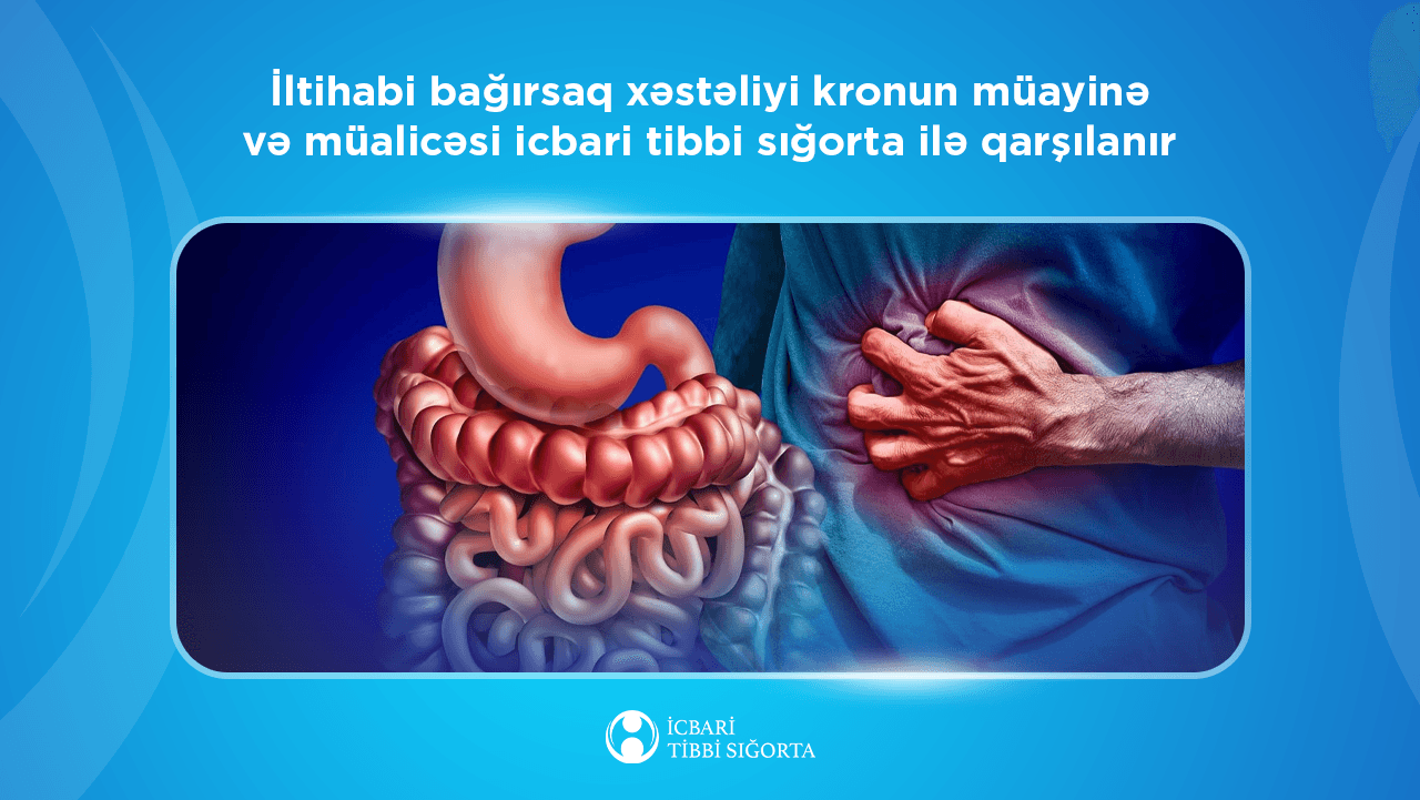 Kron xəstəliyinin müalicəsi icbari tibbi sığorta ilə qarşılanır