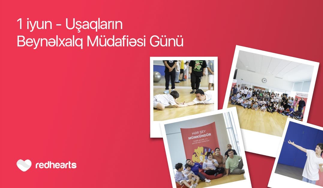 Hər şey mümkündür: Daun sindromlu uşaqlar üçün sosial layihə