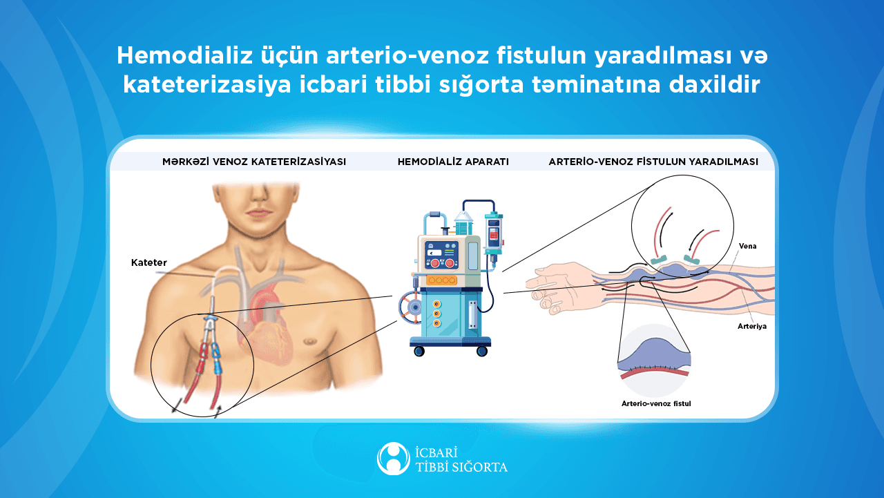 İcbari tibbi sığorta hesabına 1480-dən çox ilkin hemodializ xidməti göstərilib