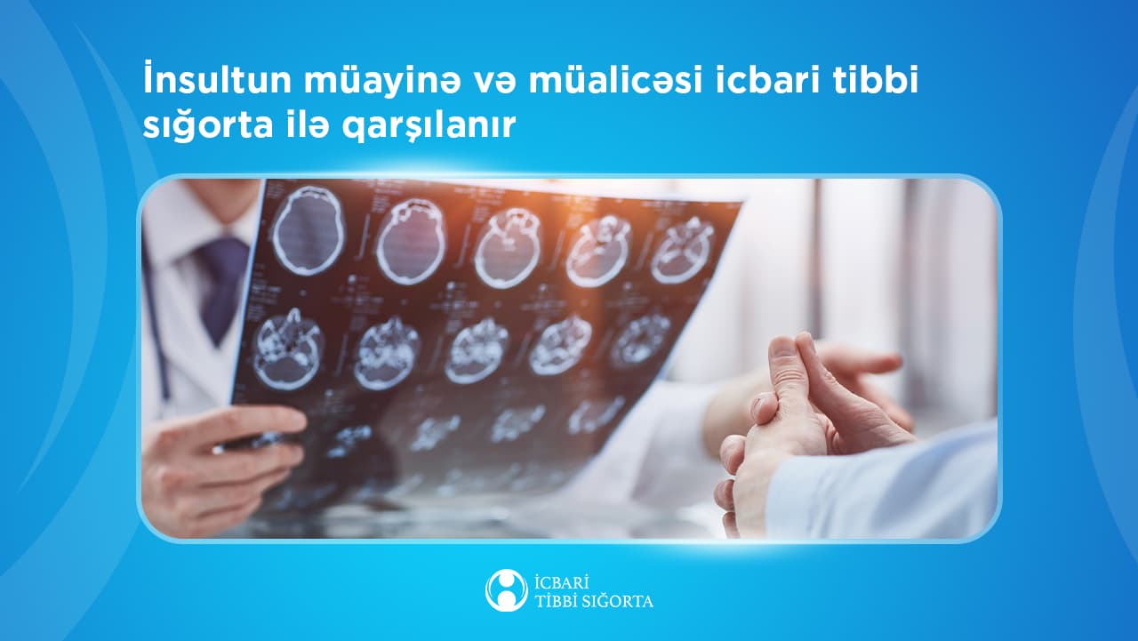 İnsultun müayinə və müalicəsi icbari tibbi sığorta ilə qarşılanır