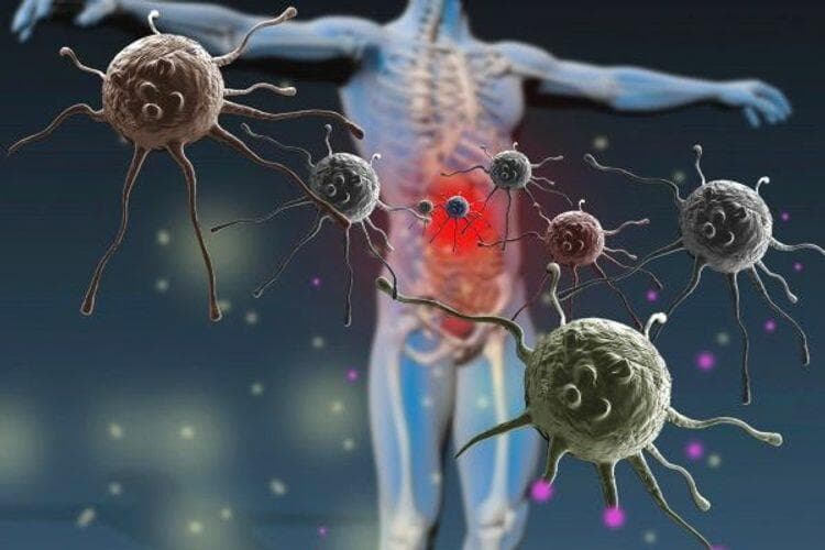 Novartis anti-xərçəng proteininin inkişafını dayandırıb