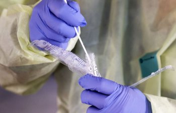 Bakıda koronavirus xəstələri üçün açılan klinikada neçə xəstə var? - RƏSMİ