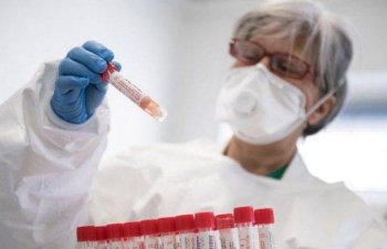 Azərbaycanda daha 30 nəfərdə koronavirus aşkarlandı