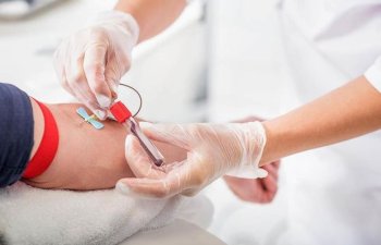 Koronavirus xəstələri üçün kimlər donor ola bilər? - RƏSMİ