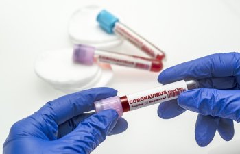 Azərbaycanda koronavirus testi neqativ çıxan şəxslərə SMS göndəriləcək