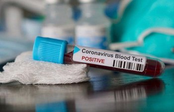 Azərbaycanda daha 121 nəfərdə koronavirus aşkarlandı - RƏSMİ +