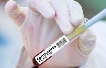 Bu ölkədə  357 nəfərə yanlışlıqla koronavirus diaqnozu qoyuldu