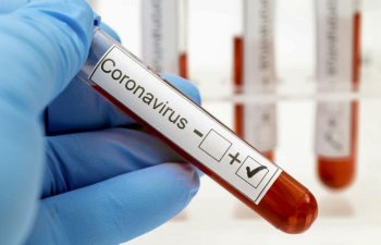 Azərbaycanda ümumilikdə 698 815 koronavirus testi aparılıb