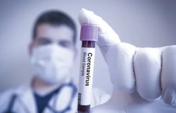Azərbaycanda indiyədək 1457177 koronavirus testi aparılıb