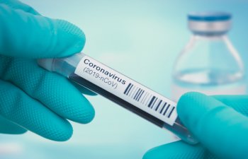 Covid-19 vaksininin “darknet”-də satışı ilə bağlı AÇIQLAMA