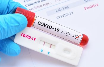 Son sutkada koronavirusa yoluxanların sayı azaldı – STATİSTİKA