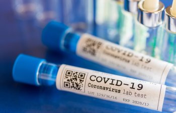 Son sutkada koronavirusa yoluxanların sayı açıqlandı – STATİSTİKA
