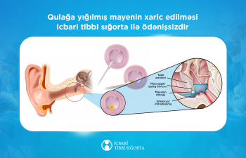 Kəskin orta otitin cərrahi müalicəsi icbari tibbi sığorta ilə qarşılanır