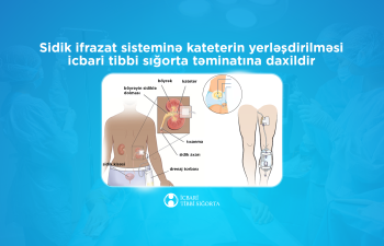 Sidik-ifrazat sisteminin katerizasiyası icbari tibbi sığorta təminatına daxildir - İTSA