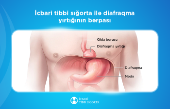 Diafraqmal yırtıqların bərpası icbari tibbi sığorta təminatına daxildir